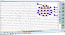 TruScan qEEG Neurofeedback Image 03